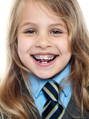 orthodontic retention